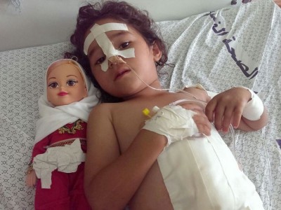 A young girl on a bed with bandages on her face, hands and body